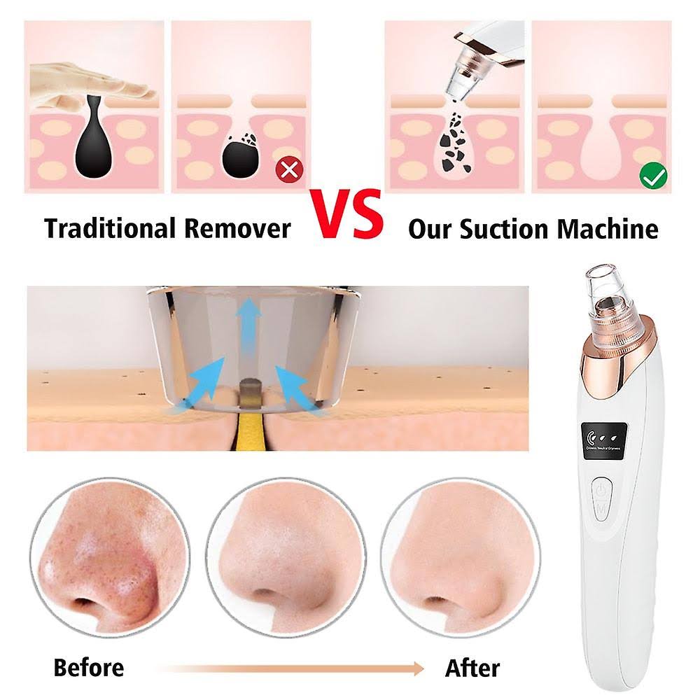 5 in 1 Multifunction Blackhead Removal Rechargeable Machine